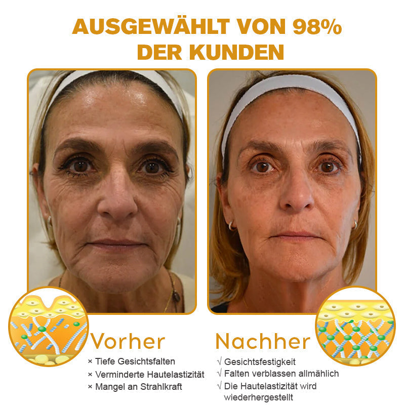 👨‍⚕️ Hergestellt in Deutschland - ✨TLOPA® Botox Bienenvenom Faltenentfernungscreme