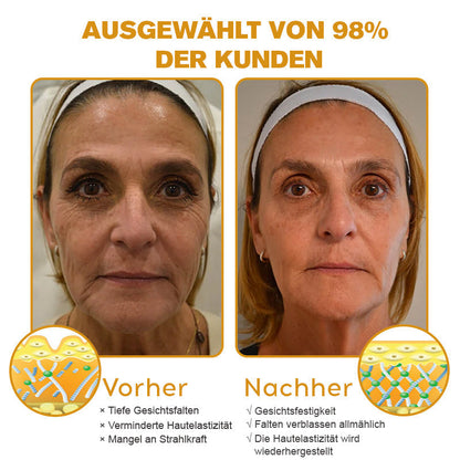 👨‍⚕️ Hergestellt in Deutschland - ✨TLOPA® Botox Bienenvenom Faltenentfernungscreme