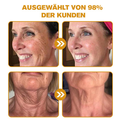 👨‍⚕️ Hergestellt in Deutschland - ✨TLOPA® Botox Bienenvenom Faltenentfernungscreme