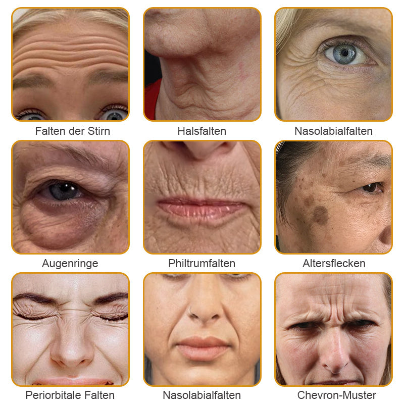 👨‍⚕️ Hergestellt in Deutschland - ✨TLOPA® Botox Bienenvenom Faltenentfernungscreme