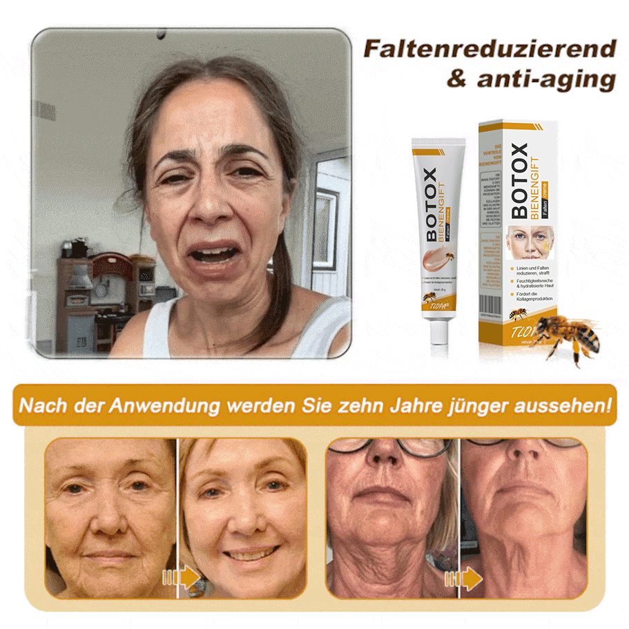 👨‍⚕️ Hergestellt in Deutschland - ✨TLOPA® Botox Bienenvenom Faltenentfernungscreme