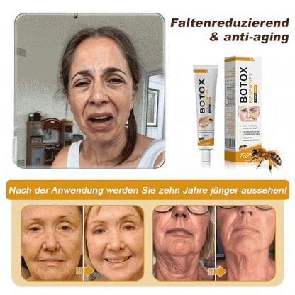 👨‍⚕️ Hergestellt in Deutschland - ✨TLOPA® Botox Bienenvenom Faltenentfernungscreme